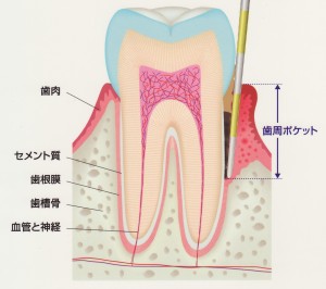 歯周ポケット検査って、なに？