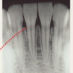 私の歯周病はよくなるの？