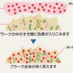 歯垢染色剤ってなに？