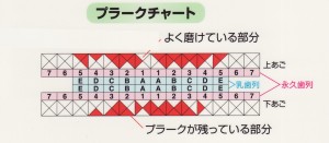 歯垢染色剤ってなに？