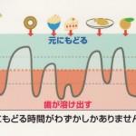 なぜ、むし歯になるの？