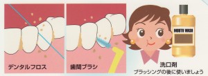 歯周病はどうしたらなおるの？